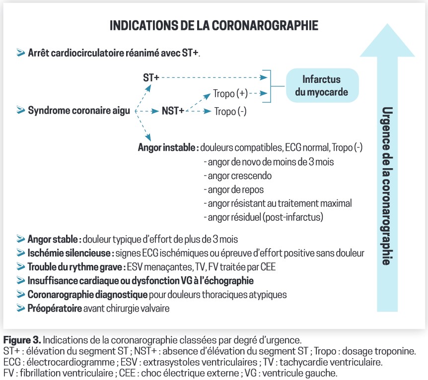 coronarographie